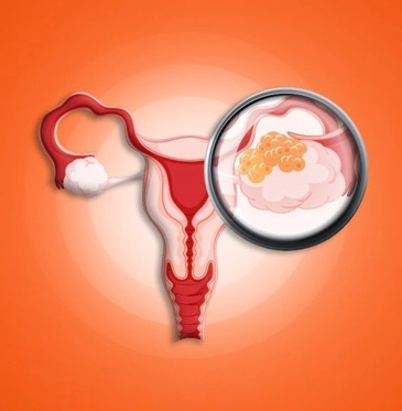 Cervical Cancer: Risk Factors And Prevention Methods